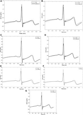Performance and Signal Quality Analysis of Electrocardiogram Textile Electrodes for Smart Apparel Applications